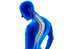 Adult Kyphosis-Types and Causes
