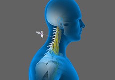 Cervical Epidurals