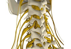 Cervical Microdiscectomy