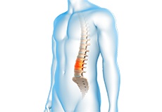 Degenerative Spinal Conditions