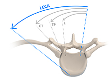 Lateral Extracavitary Approach Surgery