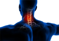 Neck Pain