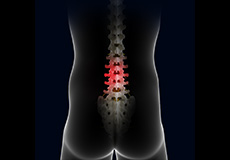 Possible Complications of Spinal Surgeries