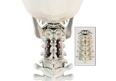 Posterior Cervical Fusion